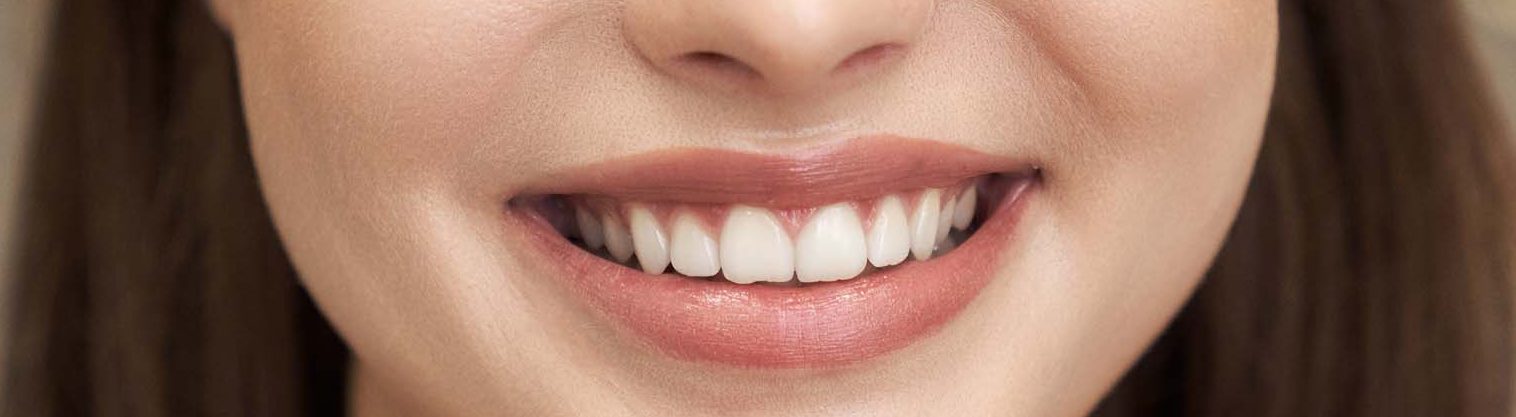 Professional tooth cleaning