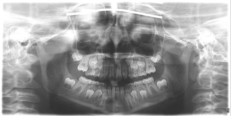 Pediatric dentistry