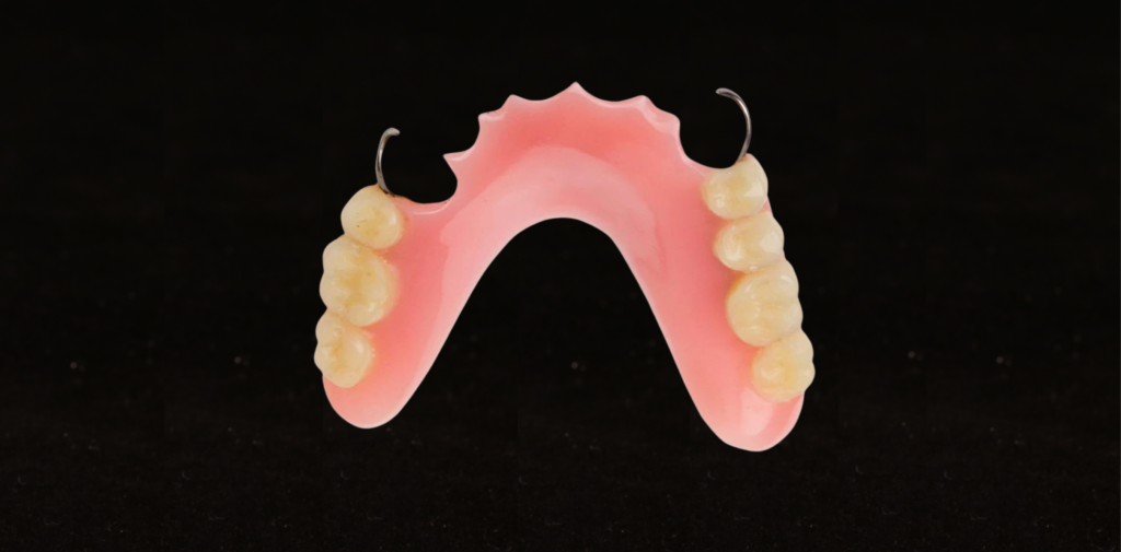 Tooth prosthetics