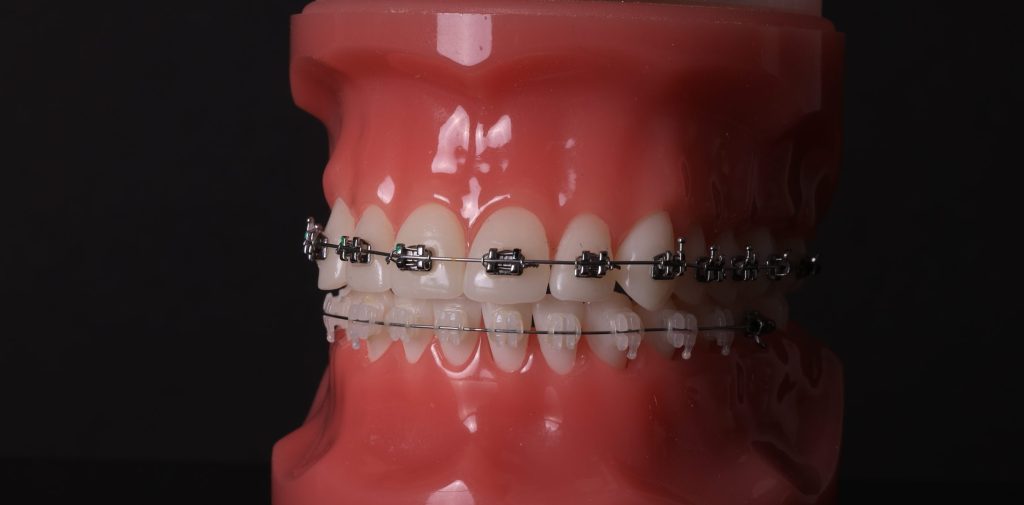 Orthodontics
