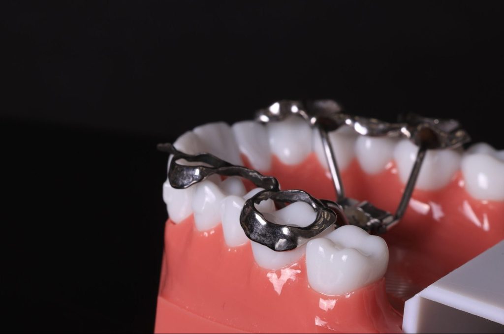 Orthodontics