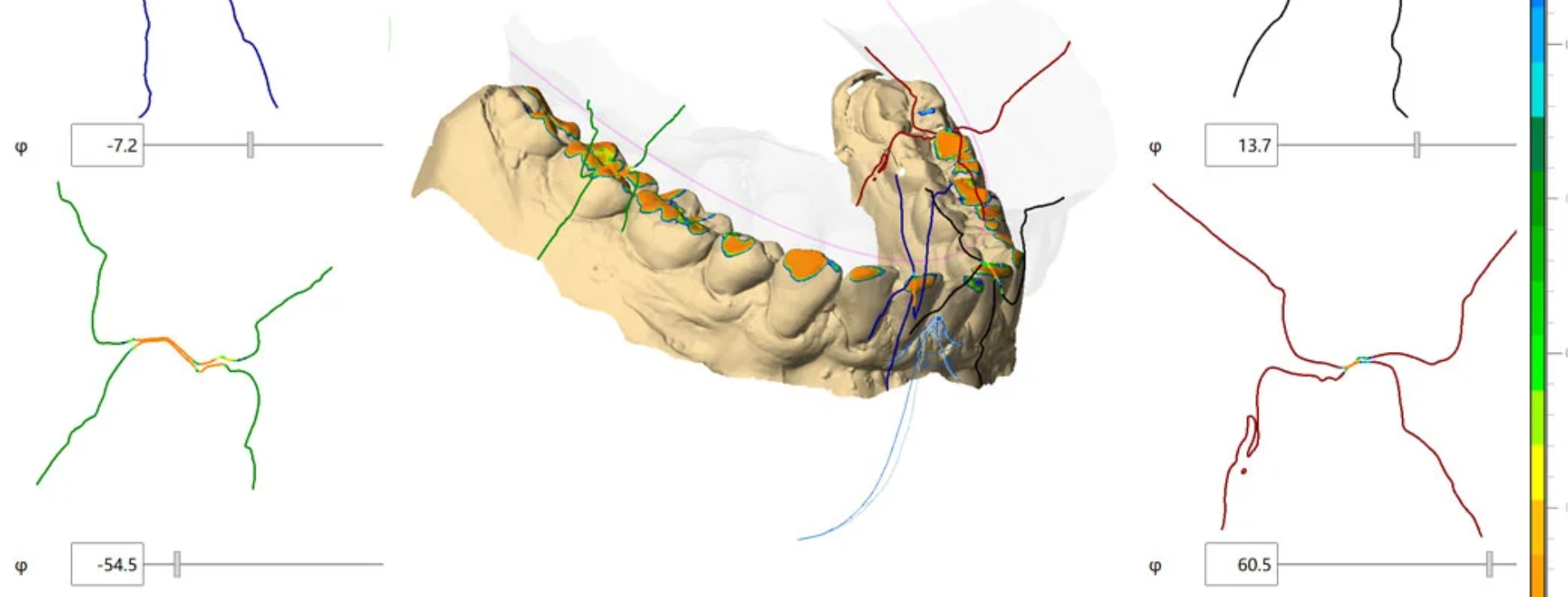 ZEBRIS JMAoptic system