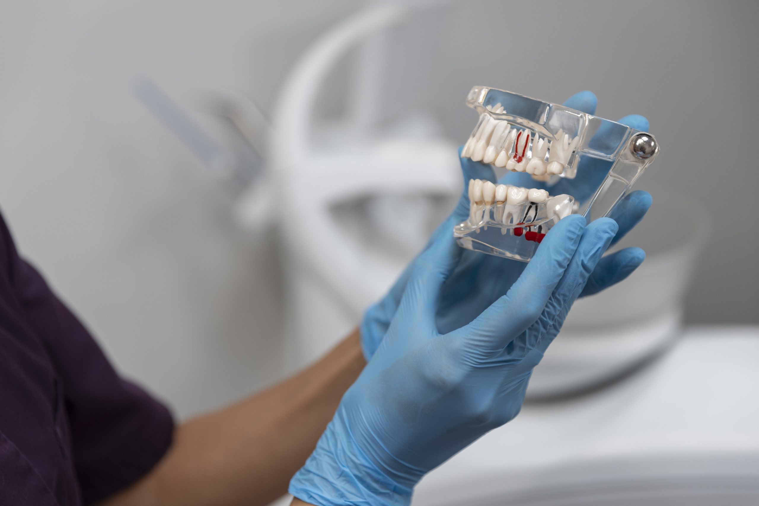 Dantų implantacija – žingsnis po žingsnio, kaip atstatomas prarastas dantis